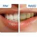 Отбеливающие полоски для зубов CREST WHITESTRIPS 3D (1 пара - для верхнего и нижнего рядов зубов)